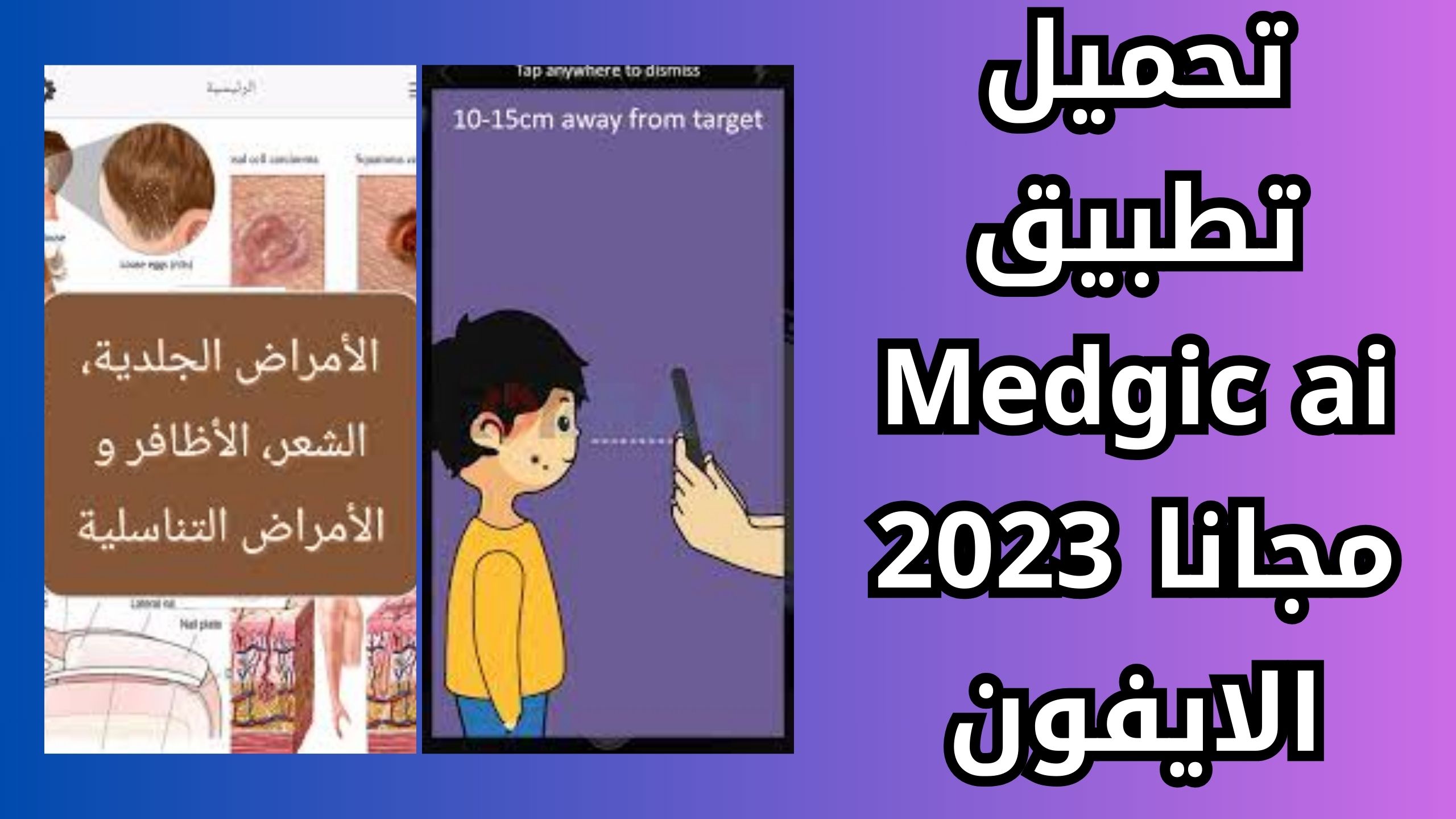 تحميل تطبيق Medgic ai لأكتشاف الأمراض الجلدية للاندرويد والايفون اخر اصدار 2024 